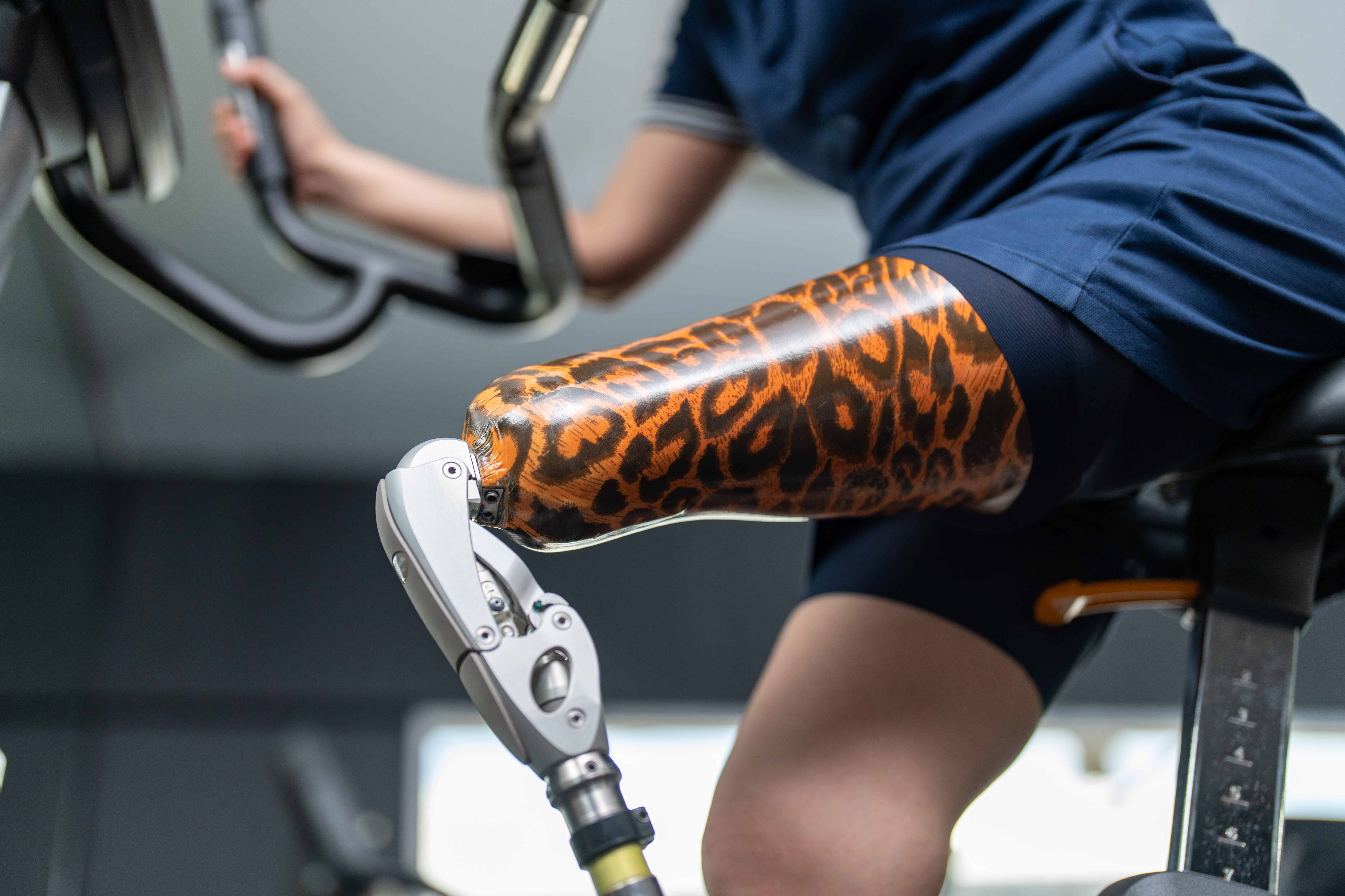 Emboîtures prothétiques