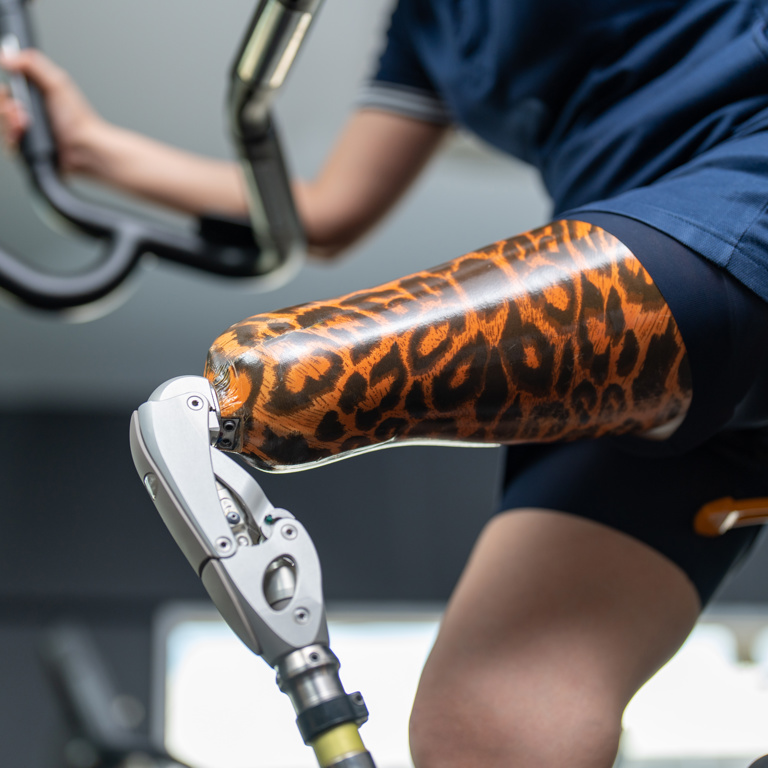 Emboîtures prothétiques